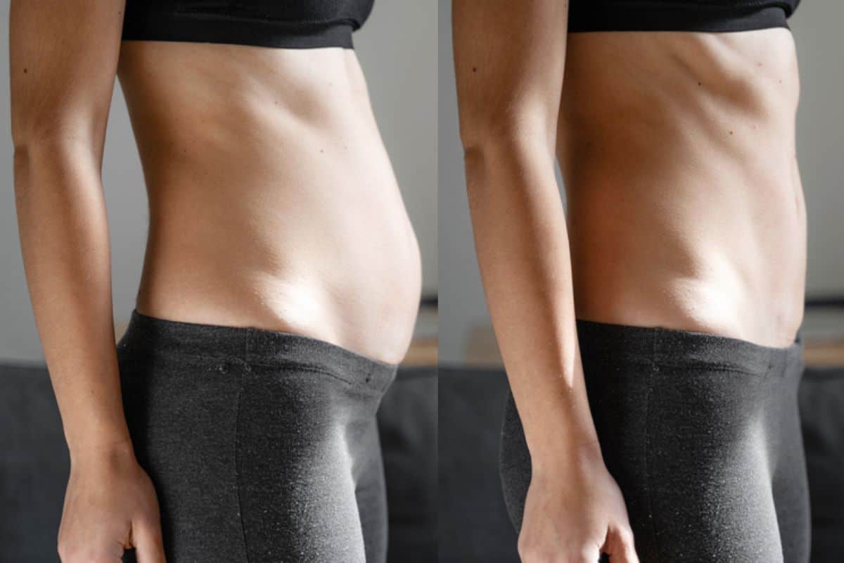 Post-Pregnancy: What Happens to Your Abdominal Muscles After Birth Suffolk