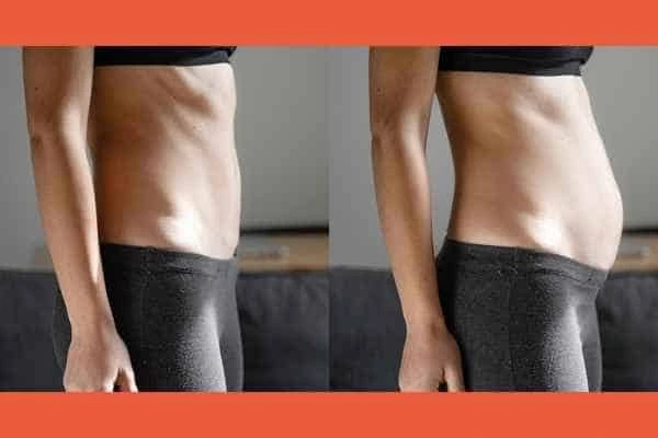 LA-EMS Body Sculpting results Suffolk
