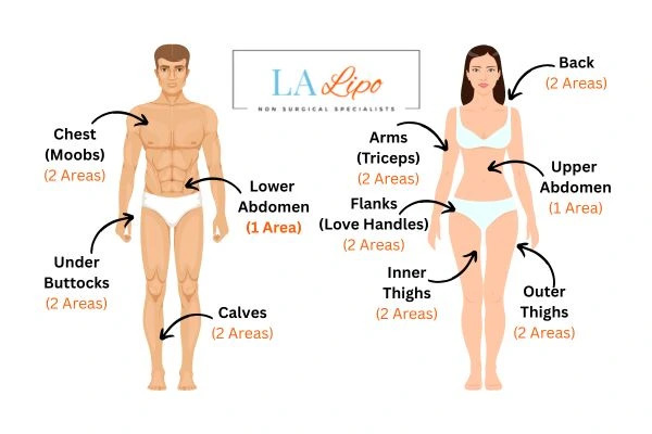 LA LIPO Cryolipolysis Areas Suffolk