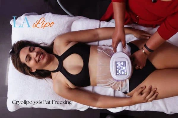 woman getting cryolipolysis Suffolk