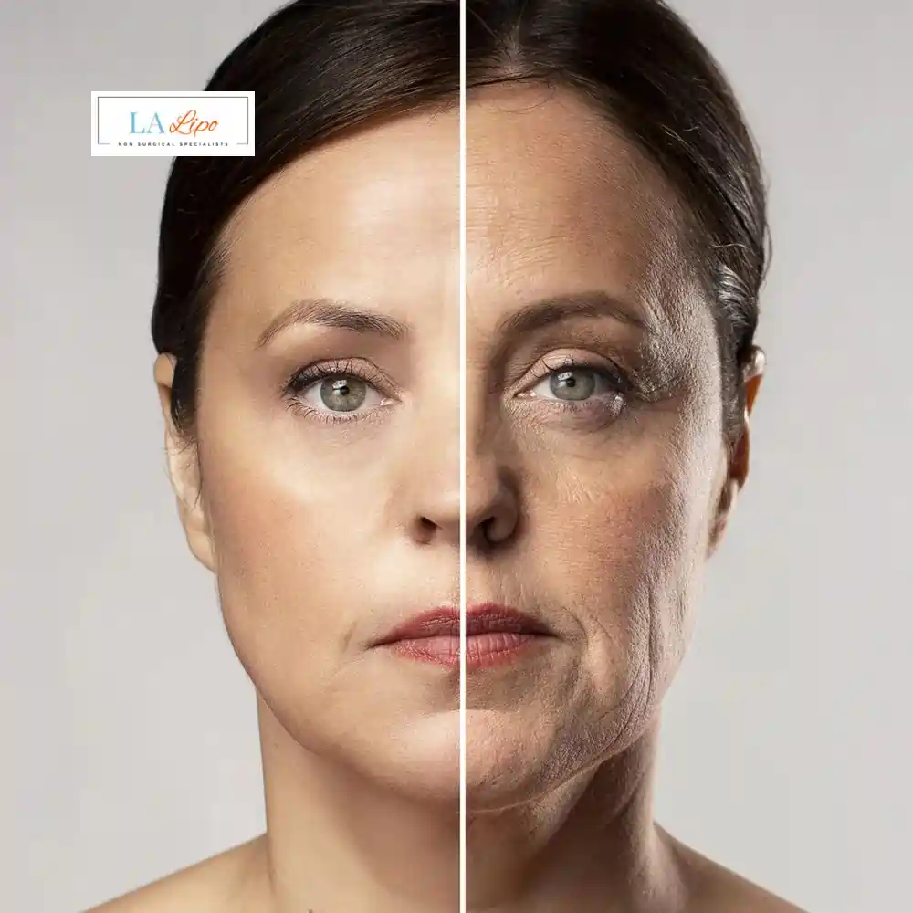 How Can You Tell If Non-Surgical Skin Tightening Is Right for You Suffolk?