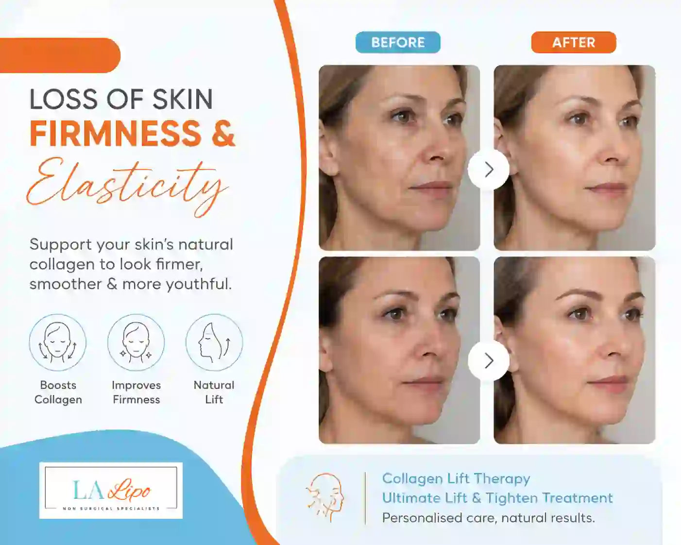 Sign #7: Loss of Skin Firmness and Elasticity Suffolk